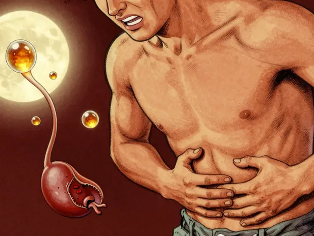 Gallstones Explained: Biliary Colic, Cholecystitis, and When Surgery Is Necessary